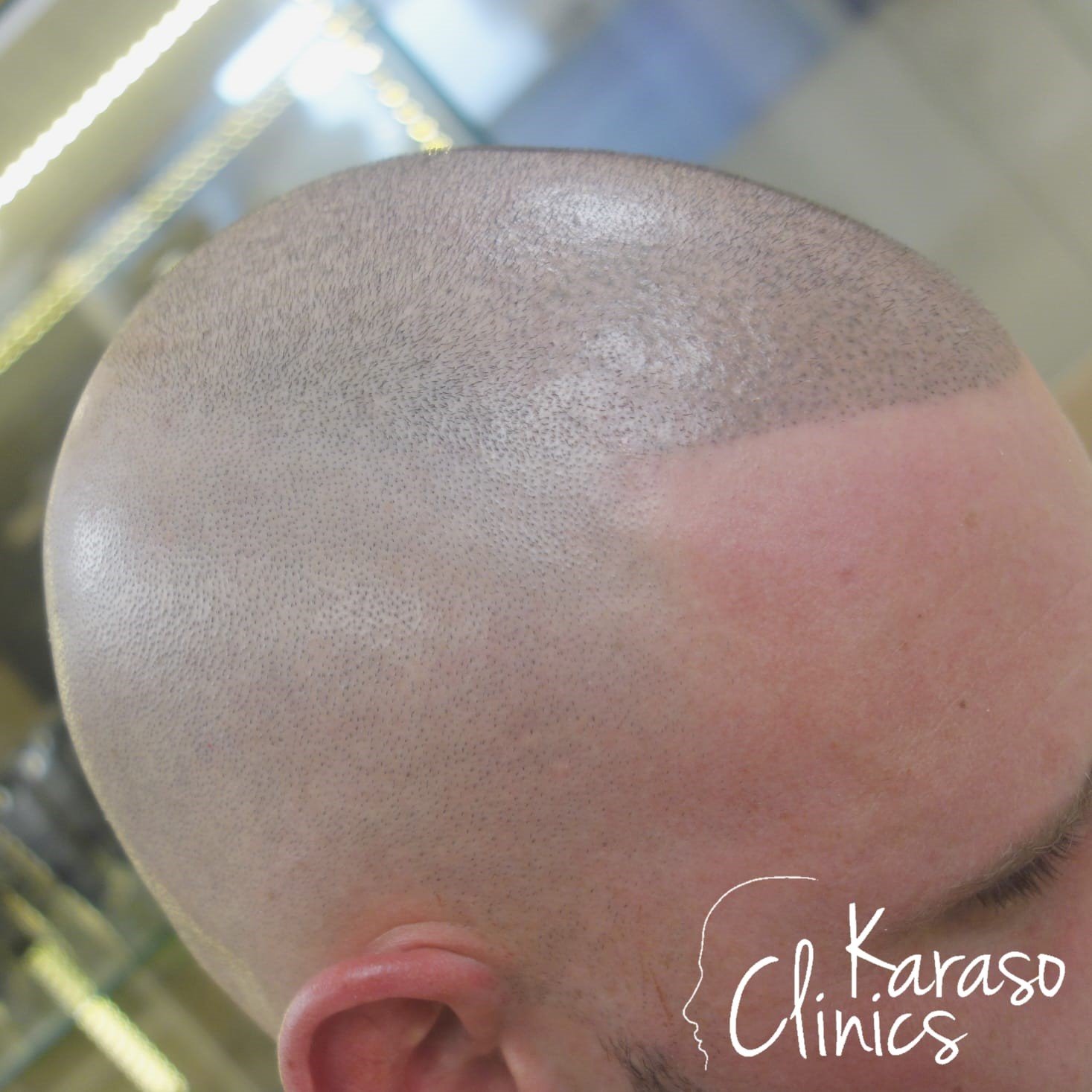 הדמיית שיער