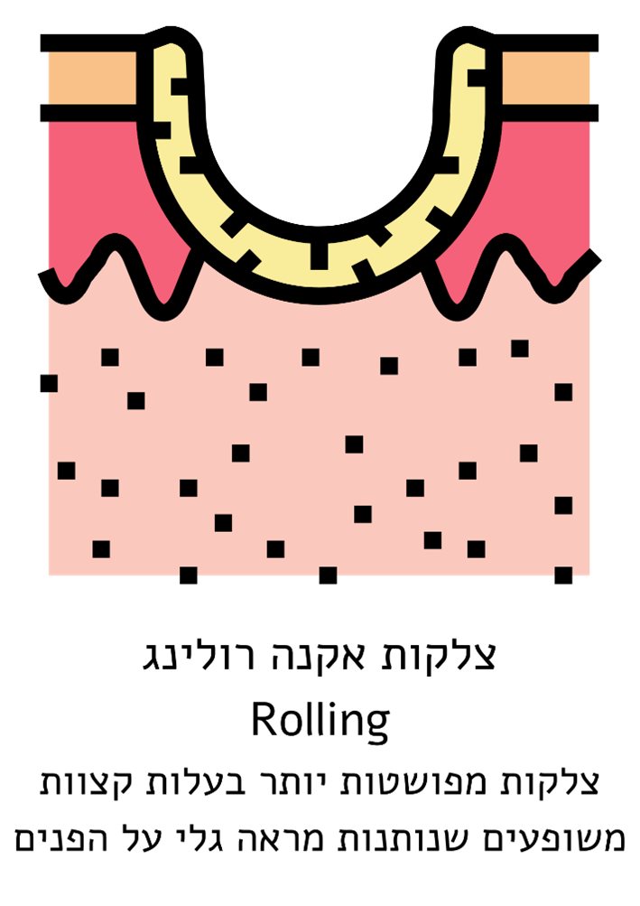 קרדיט CANVA