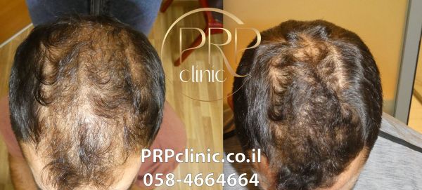 קרדיט  אלמד וורלד